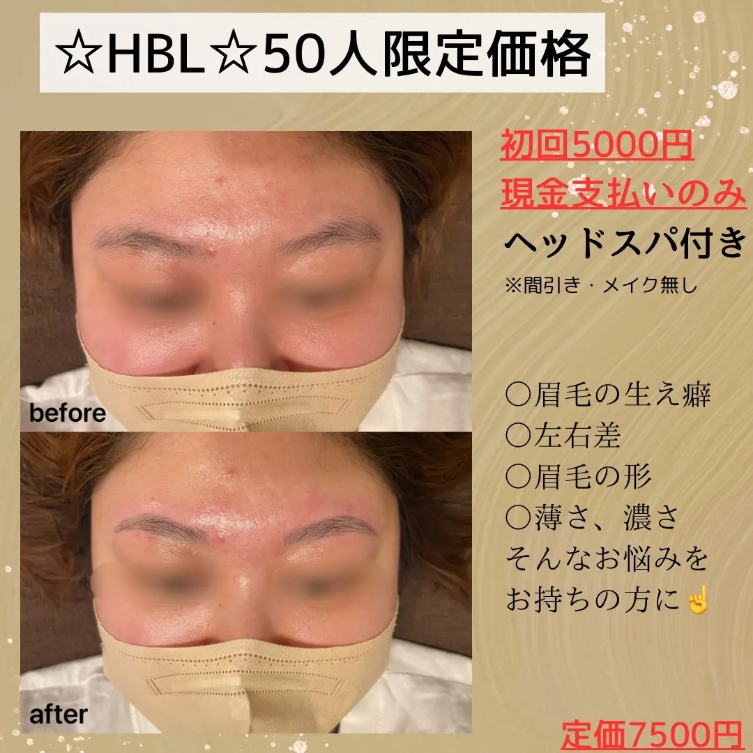 【ハリウッドブロウリフト/ビフォーアフター】